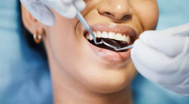 Best Emergency Dental Care for Broken or Chipped Teeth in Arcade, GA