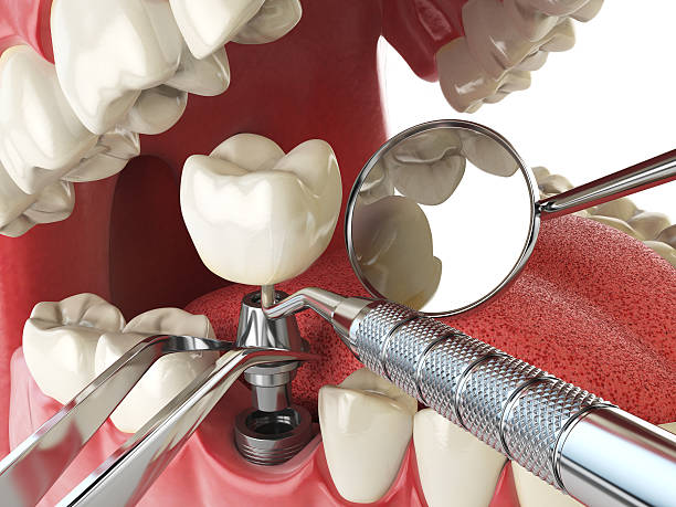 Trusted GA Emergency Dentist Experts